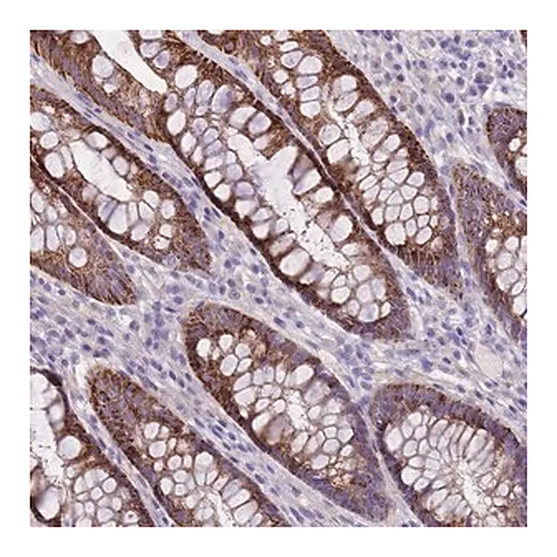 Merck Anti-RIPPLY2 antibody produced in rabbit