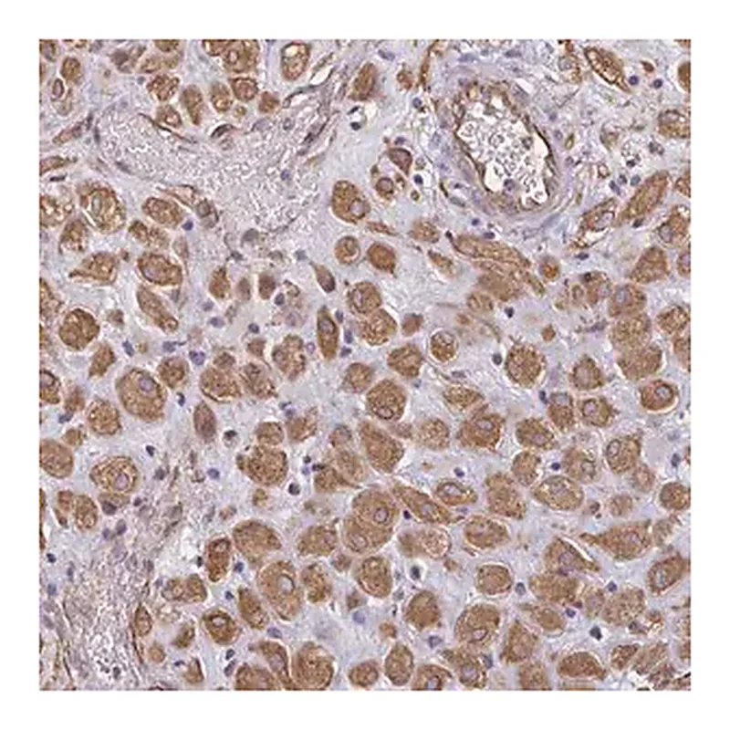 Merck Anti-TRPV6 antibody produced in rabbit