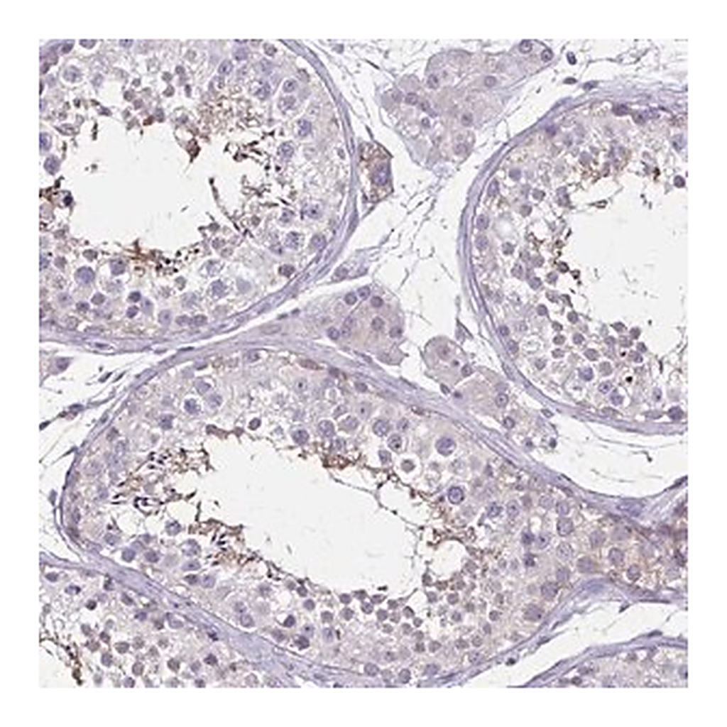 Merck Anti-ULBP3 antibody produced in rabbit