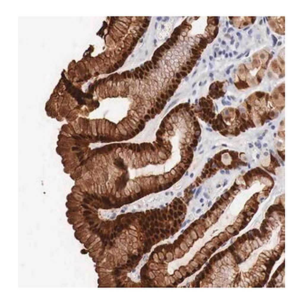 Merck Anti-ITIH6 antibody produced in rabbit