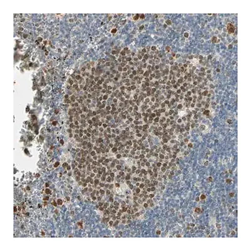 Merck Anti-RAD18 antibody produced in rabbit