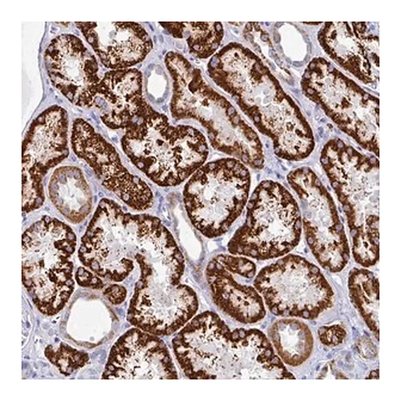 Merck Anti-SETBP1 antibody produced in rabbit