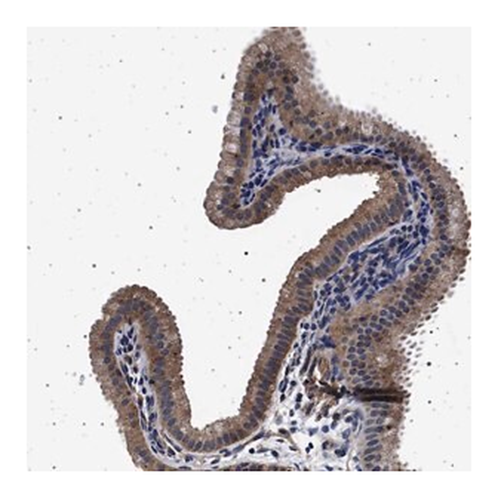 Merck Anti-MAP3K2 antibody produced in rabbit