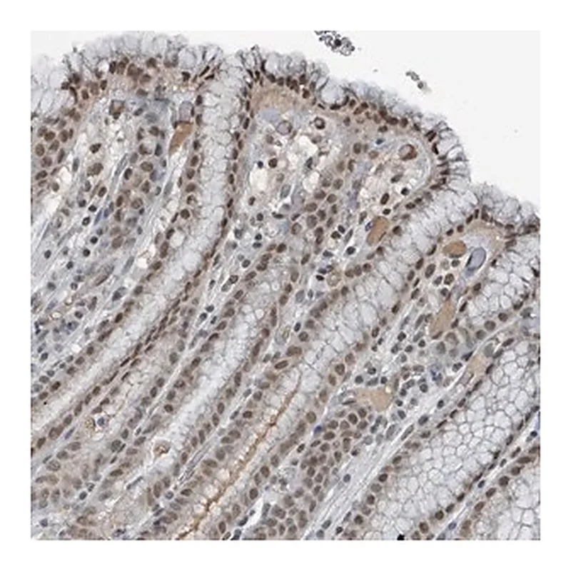 Merck Anti-PHIP antibody produced in rabbit