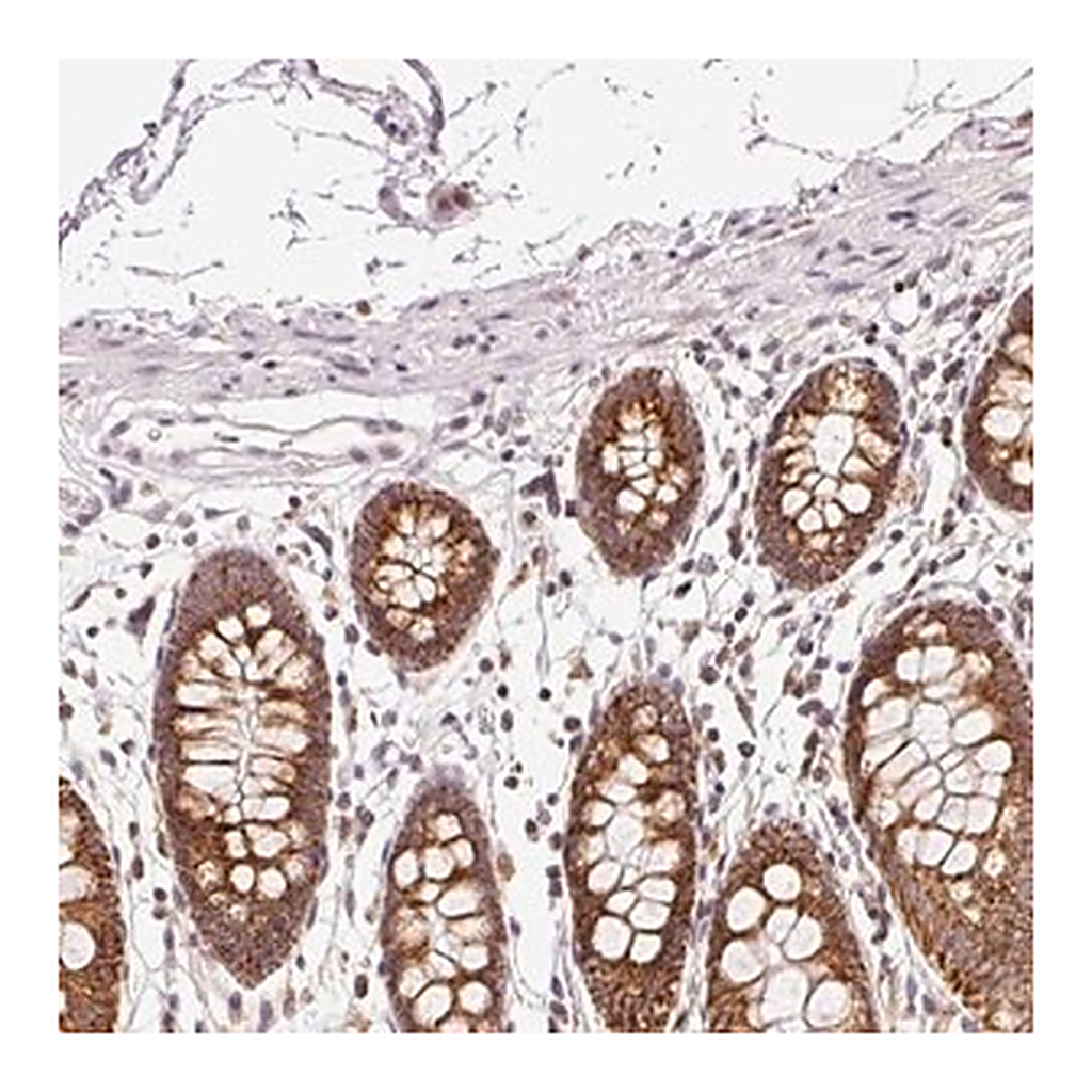 Merck Anti-ABHD11 antibody produced in rabbit