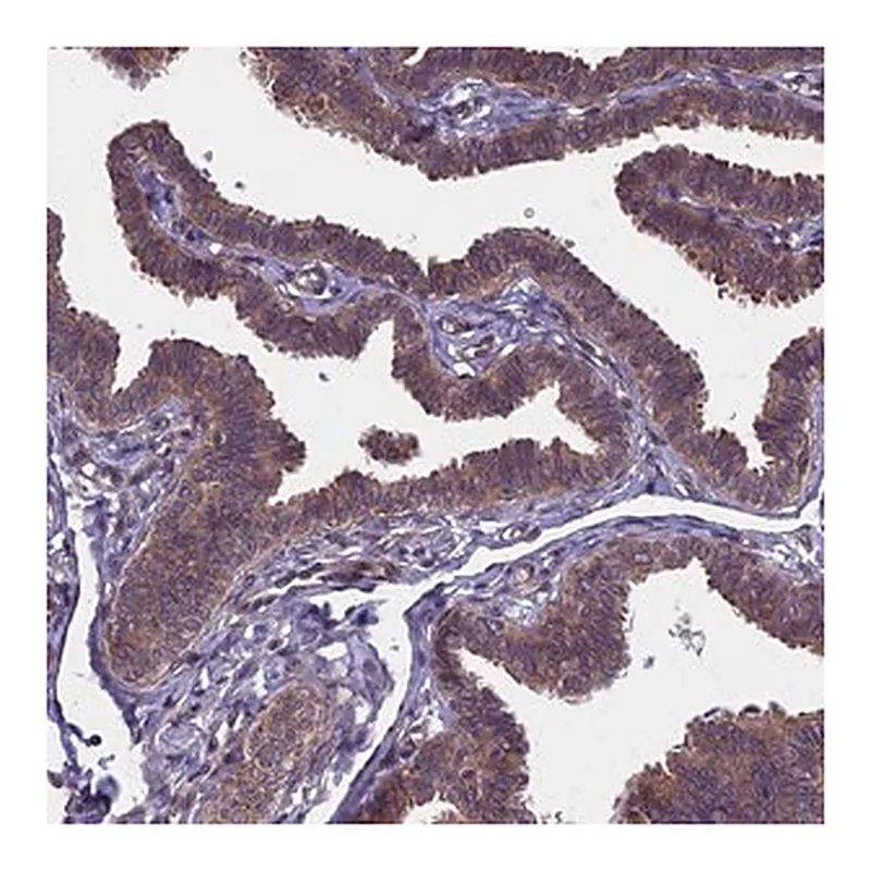 Merck Anti-NAA10 antibody produced in rabbit