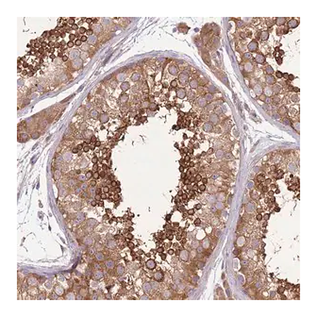 Merck Anti-PRKAR1A antibody produced in rabbit