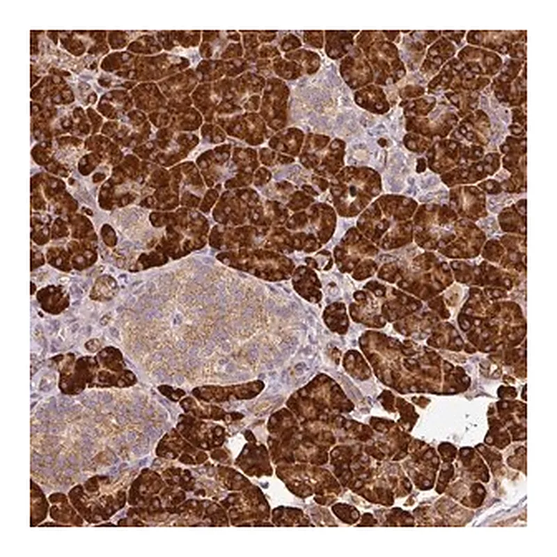 Merck Anti-ANKRD18A antibody produced in rabbit