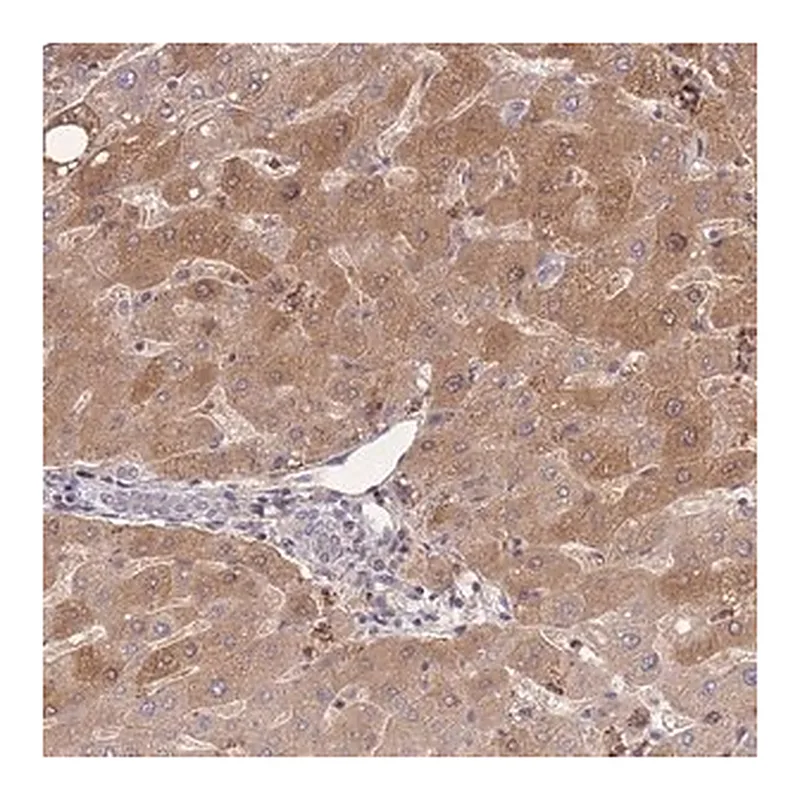 Merck Anti-ZNF304 antibody produced in rabbit