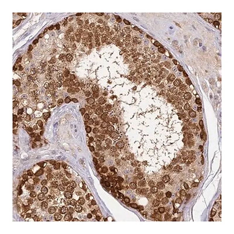 Merck Anti-YAE1D1 antibody produced in rabbit