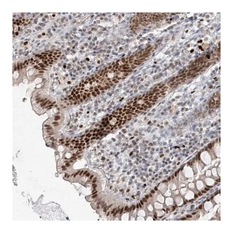 Merck Anti-AK9 antibody produced in rabbit