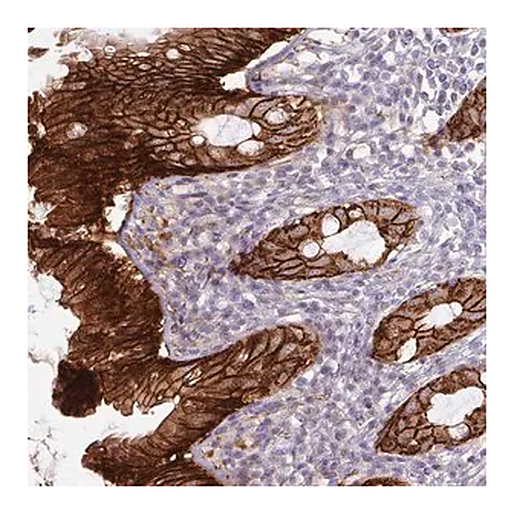 Merck Anti-JUP antibody produced in rabbit
