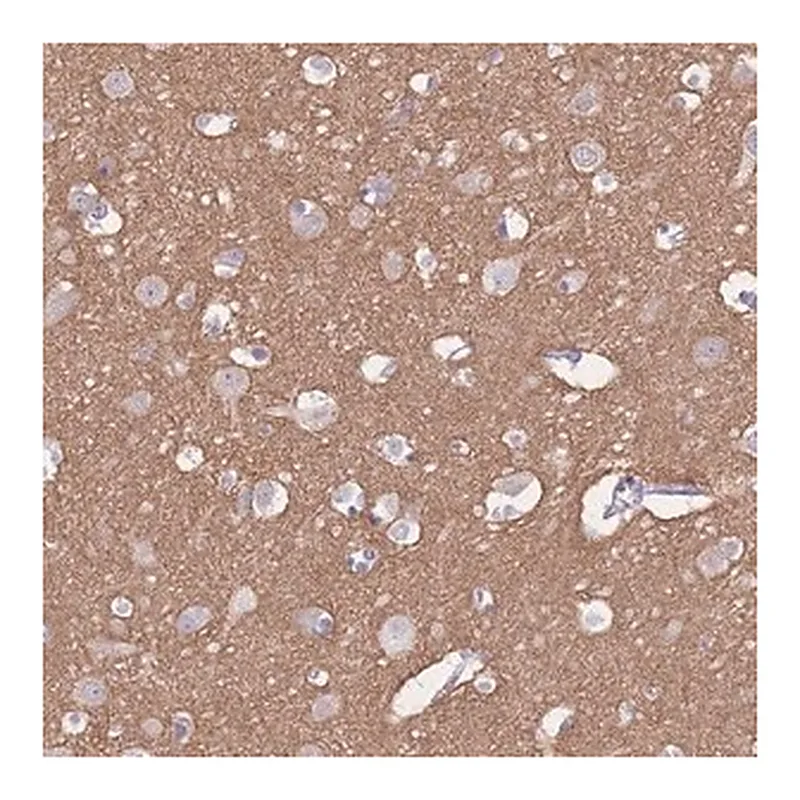 Merck Anti-ADD2 antibody produced in rabbit