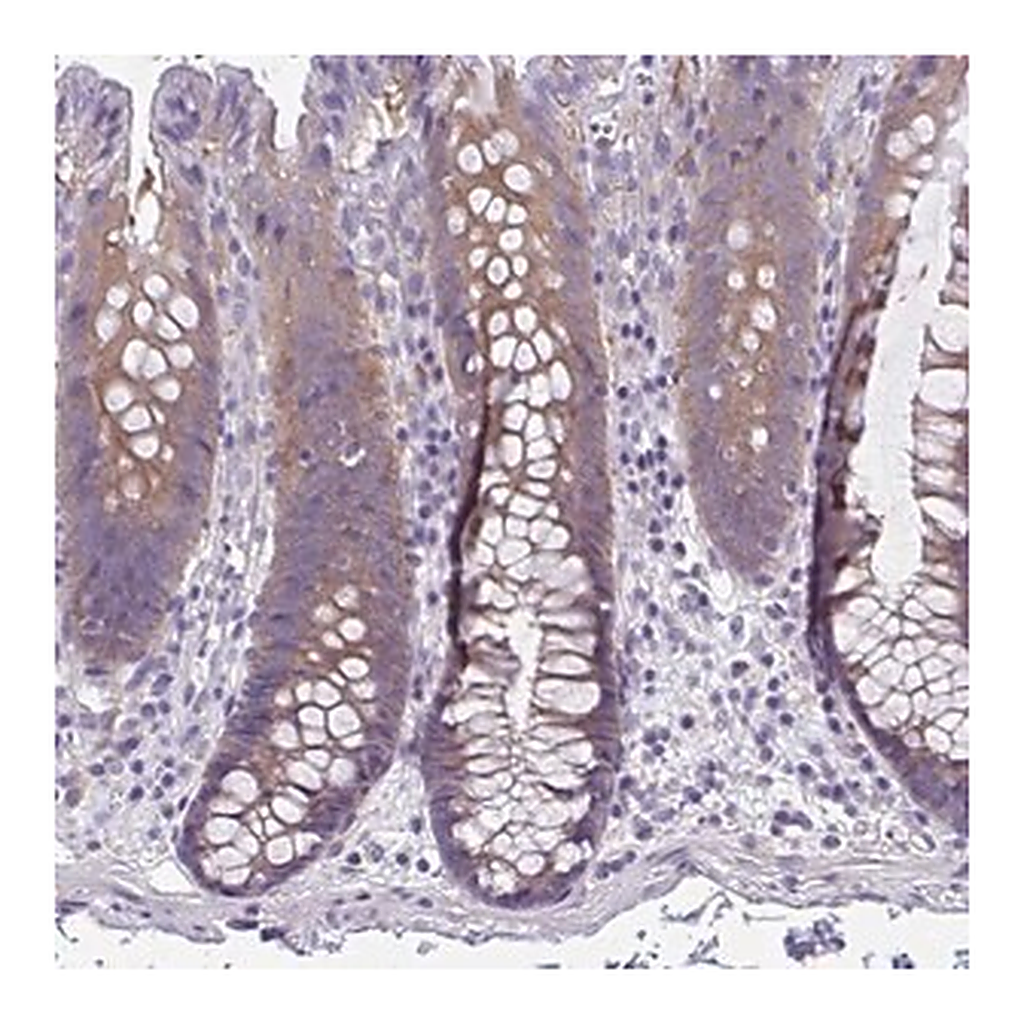 Merck Anti-LPIN3 antibody produced in rabbit