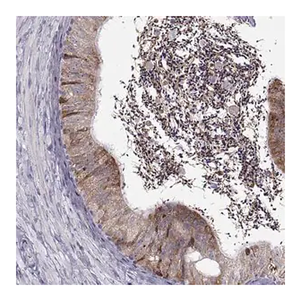 Merck Anti-ROPN1B antibody produced in rabbit