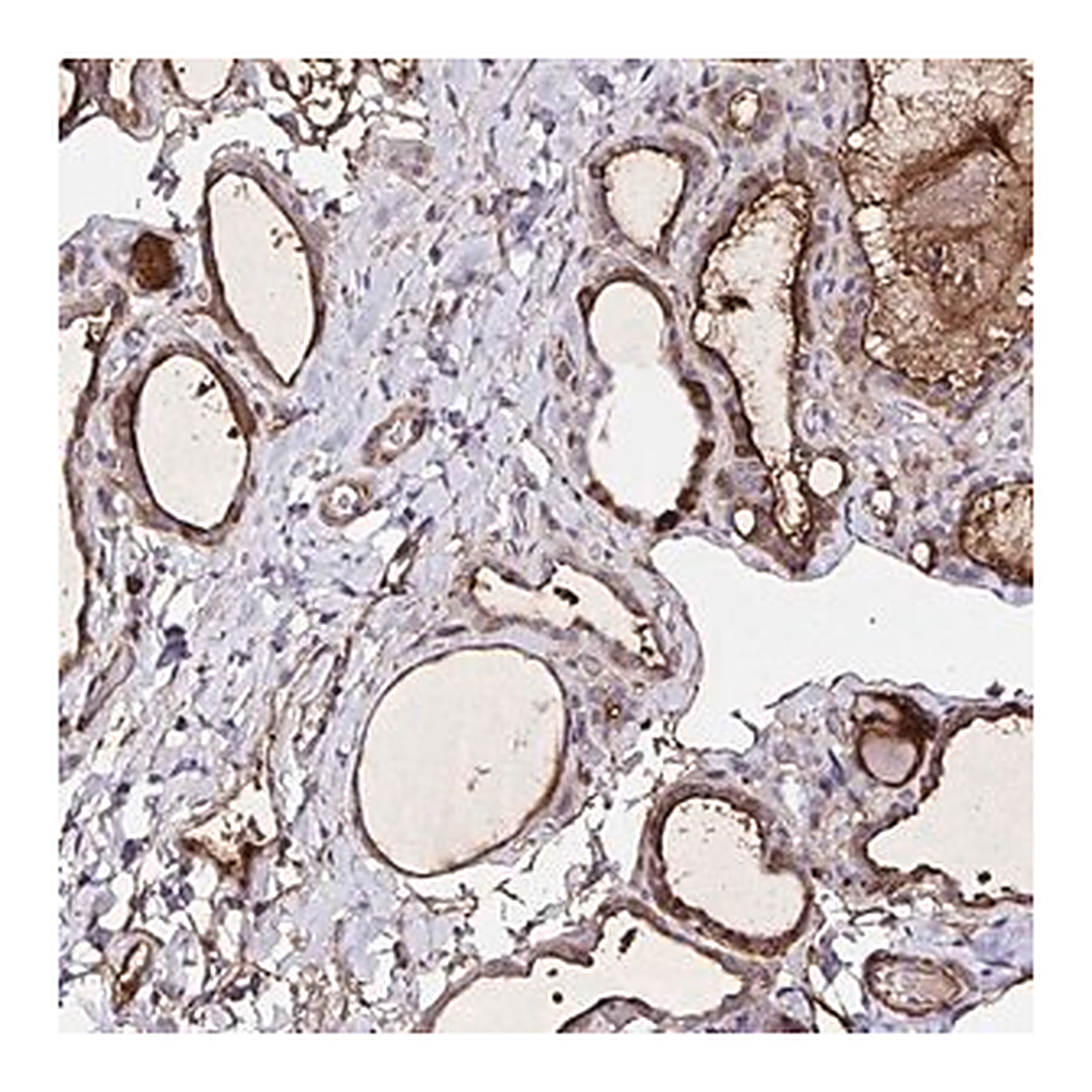 Merck Anti-FBXO34 antibody produced in rabbit