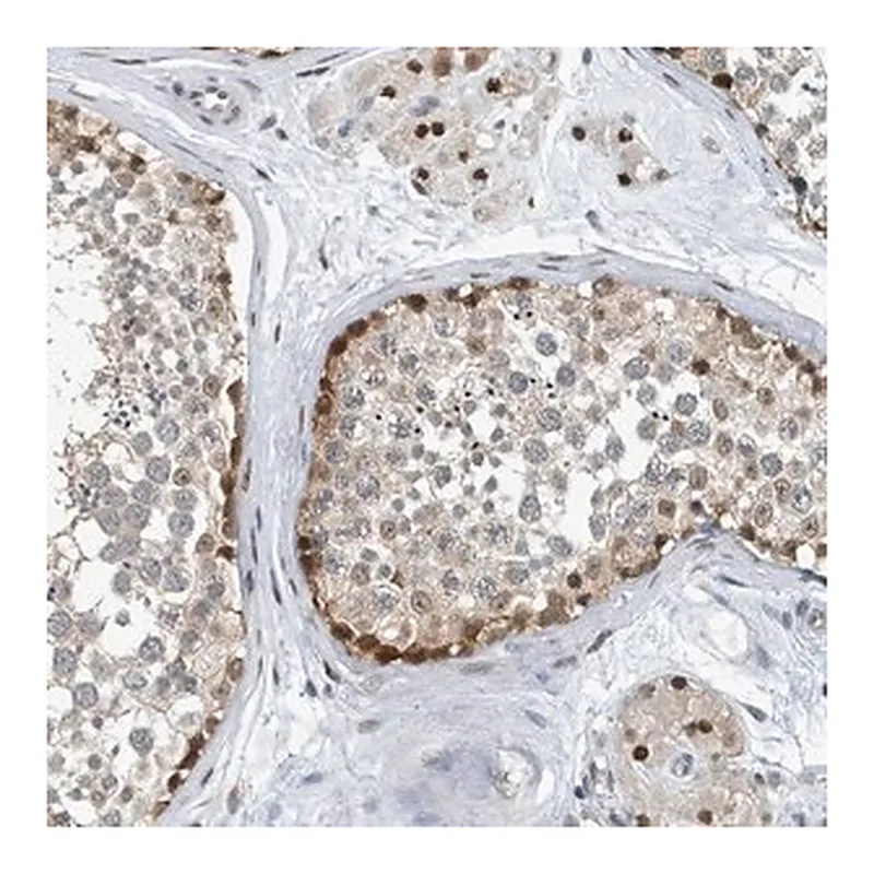 Merck Anti-KIF15 antibody produced in rabbit