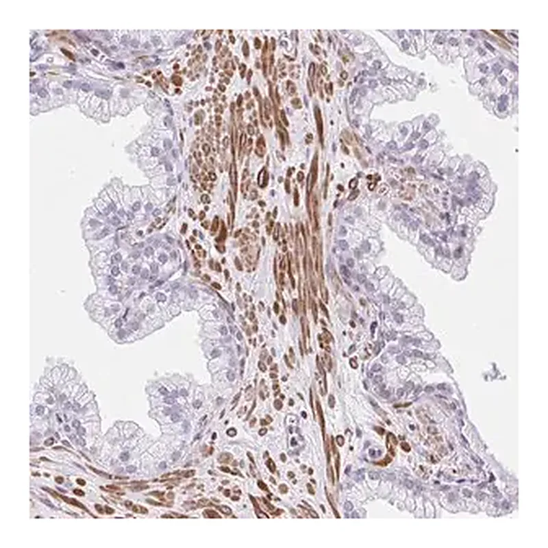 Merck Anti-KCNN4 antibody produced in rabbit