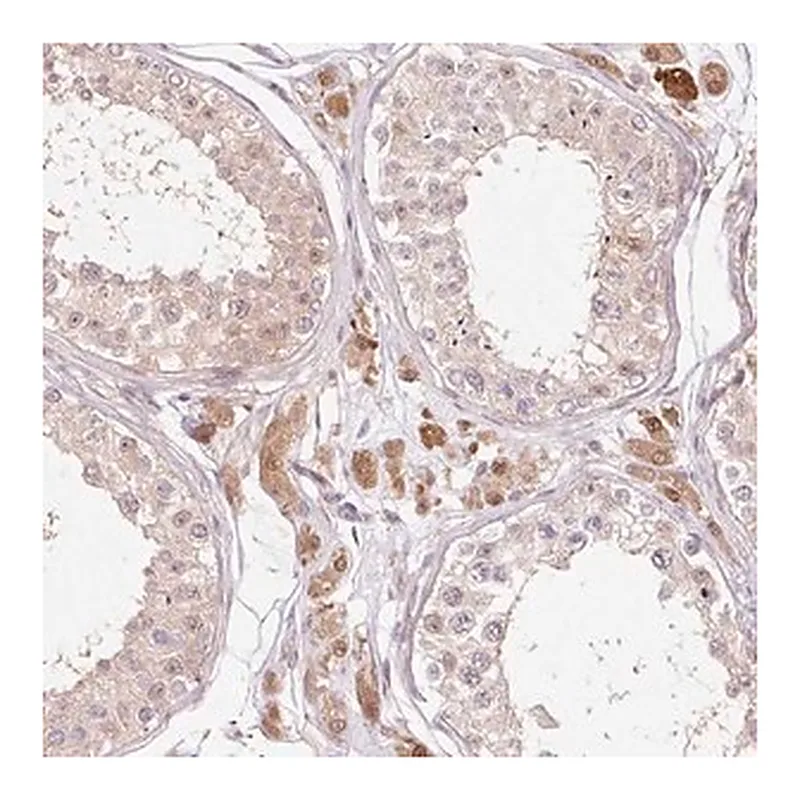 Merck Anti-FBXL14 antibody produced in rabbit