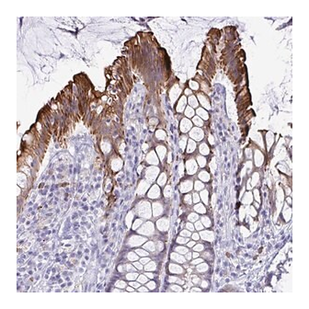 Merck Anti-TAS2R38 antibody produced in rabbit