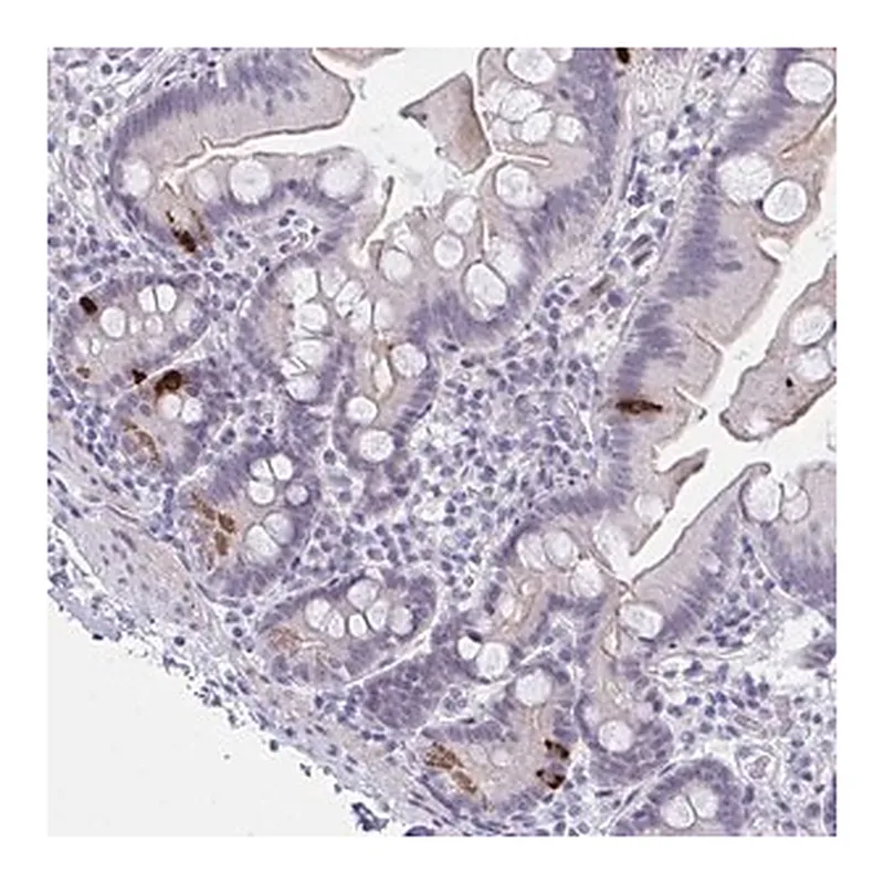 Merck Anti-FBXL22 antibody produced in rabbit