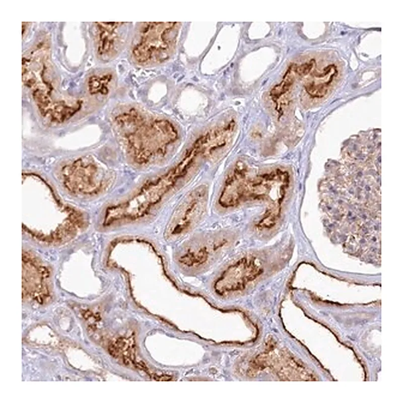 Merck Anti-ALDH3B1 antibody produced in rabbit