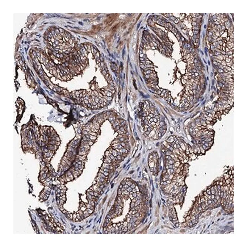 Merck Anti-TBCEL antibody produced in rabbit