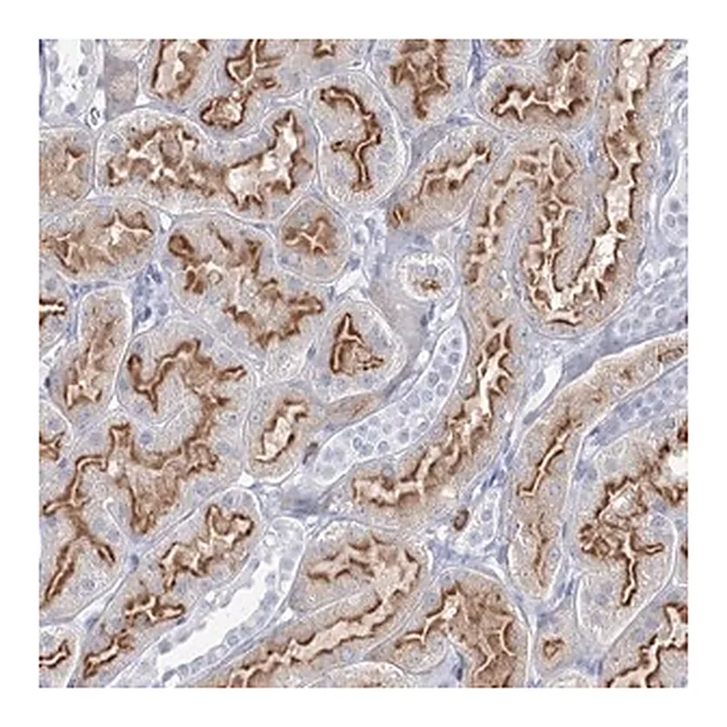 Merck Anti-CCDC73 antibody produced in rabbit