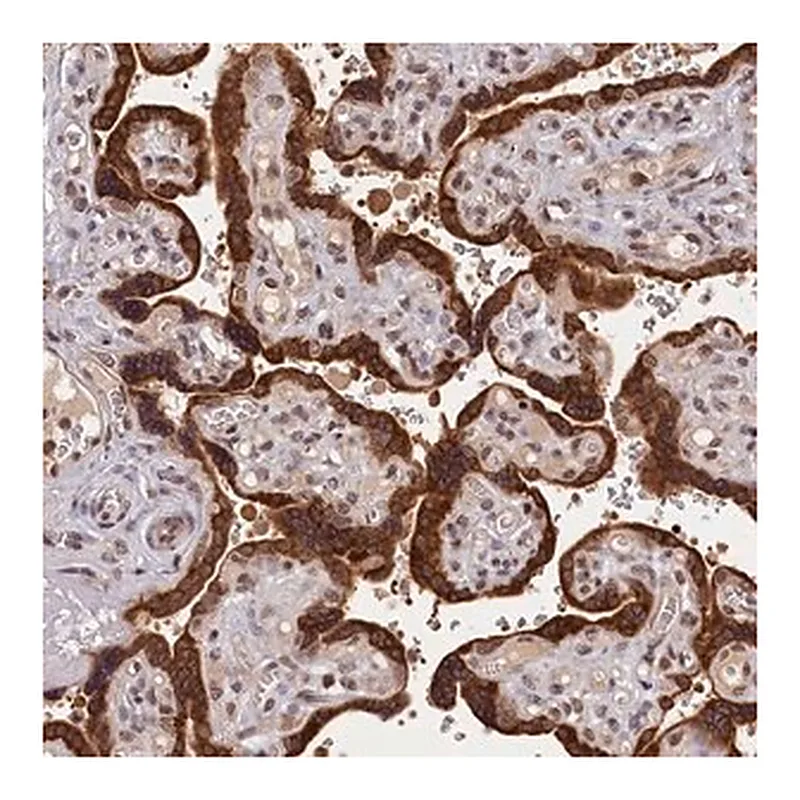 Merck Anti-KCNK6 antibody produced in rabbit