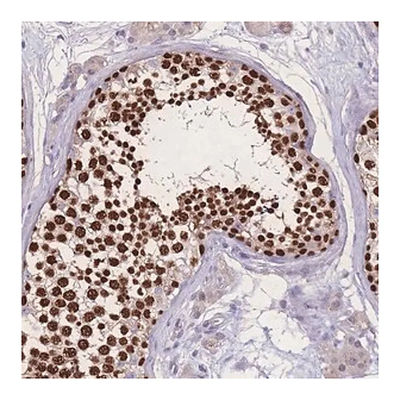 Merck Anti-ZNF662 antibody produced in rabbit