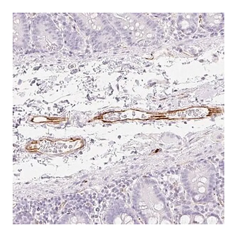 Merck Anti-ZNF689 antibody produced in rabbit