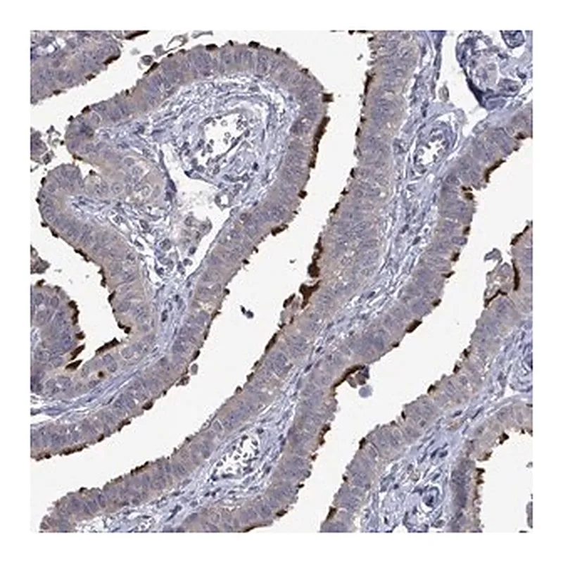 Merck Anti-POMGNT2 antibody produced in rabbit