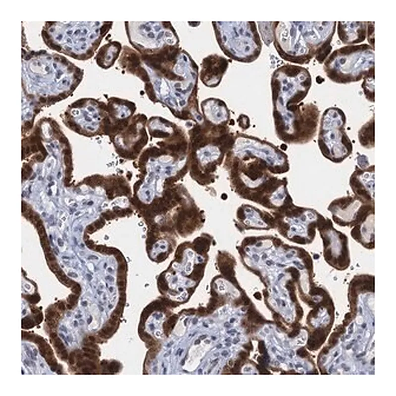 Merck Anti-EPS8L1 antibody produced in rabbit