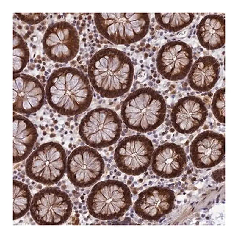 Merck Anti-ZNF428 antibody produced in rabbit