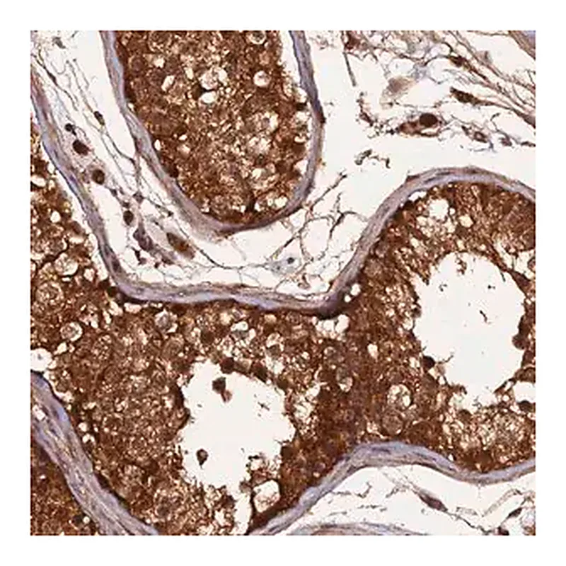 Merck Anti-RALGAPA2 antibody produced in rabbit