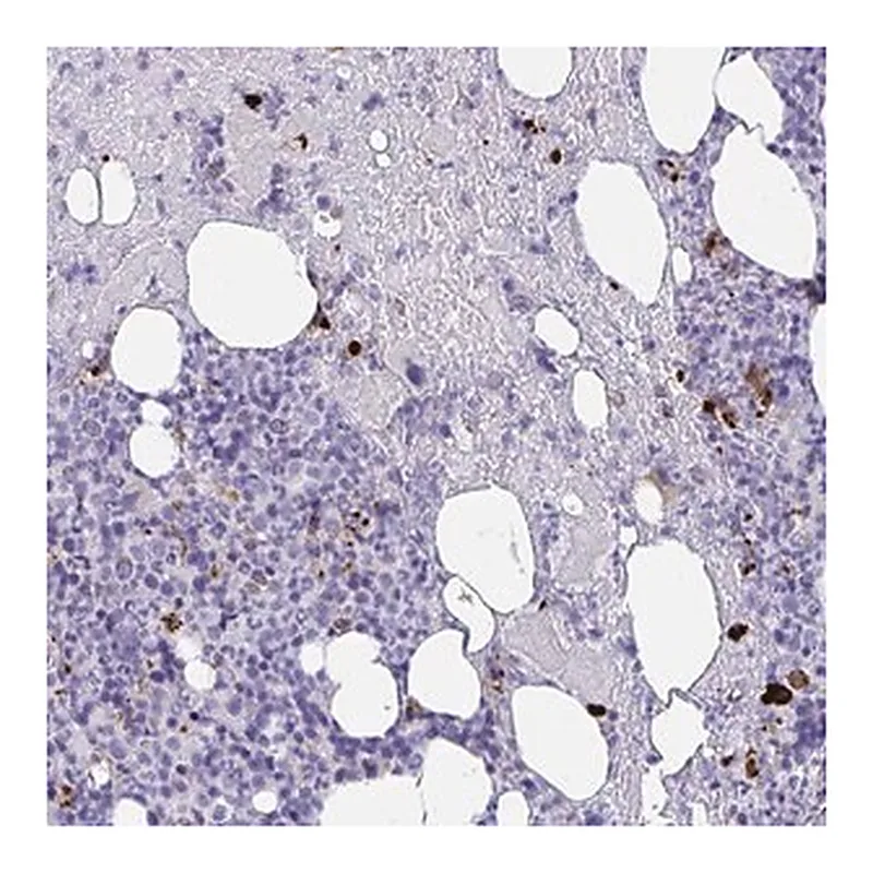 Merck Anti-KMT2E antibody produced in rabbit