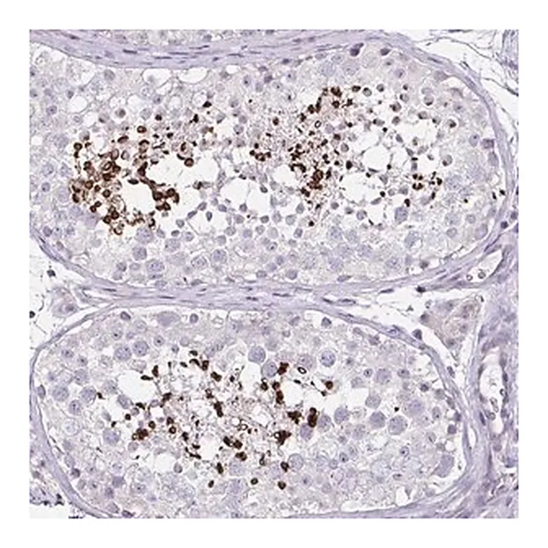 Merck Anti-D2HGDH antibody produced in rabbit