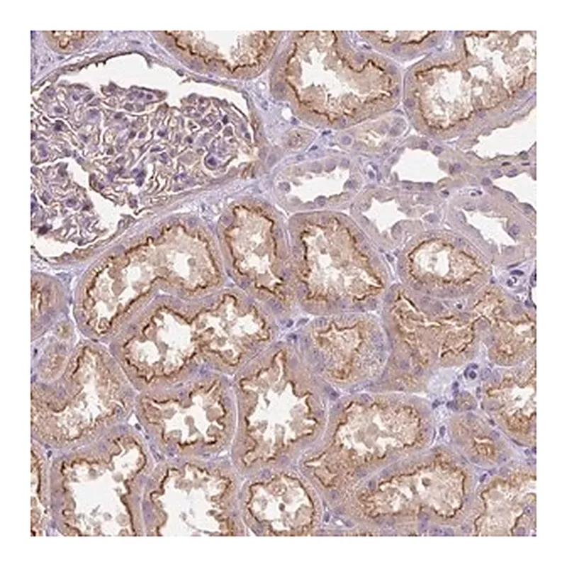 Merck Anti-PIP5KL1 antibody produced in rabbit