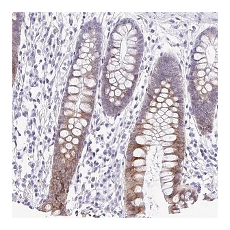 Merck Anti-PIGK antibody produced in rabbit