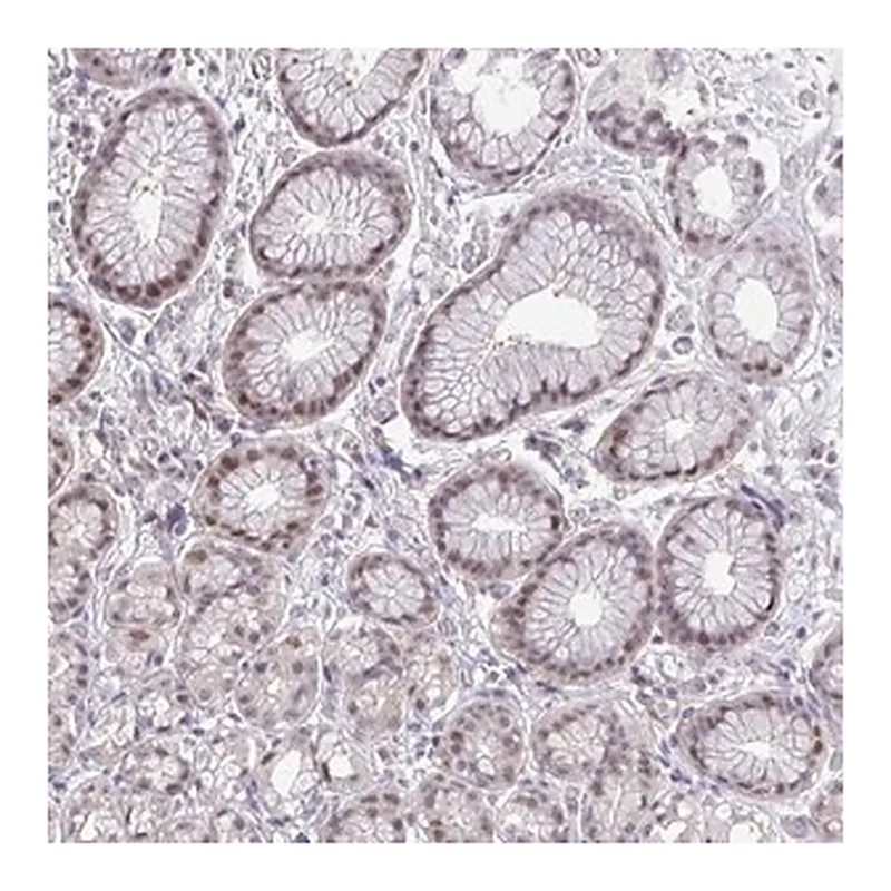 Merck Anti-ZNF444 antibody produced in rabbit