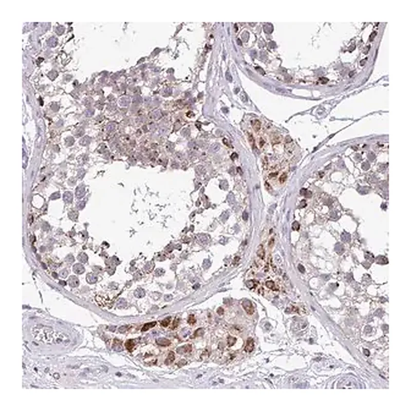 Merck Anti-SARS2 antibody produced in rabbit