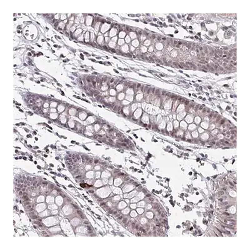 Merck Anti-SETBP1 antibody produced in rabbit
