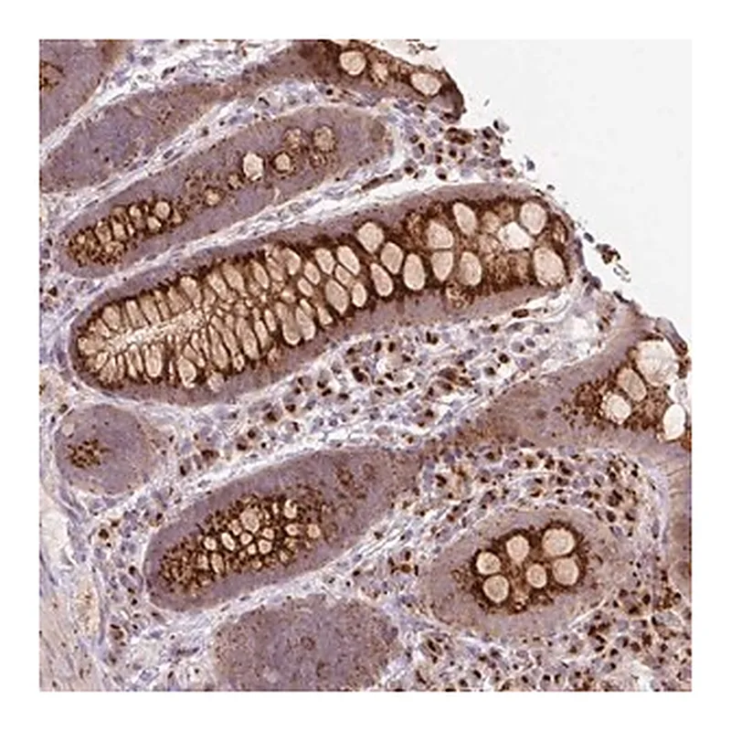 Merck Anti-RP11-111M22.2 antibody produced in rabbit