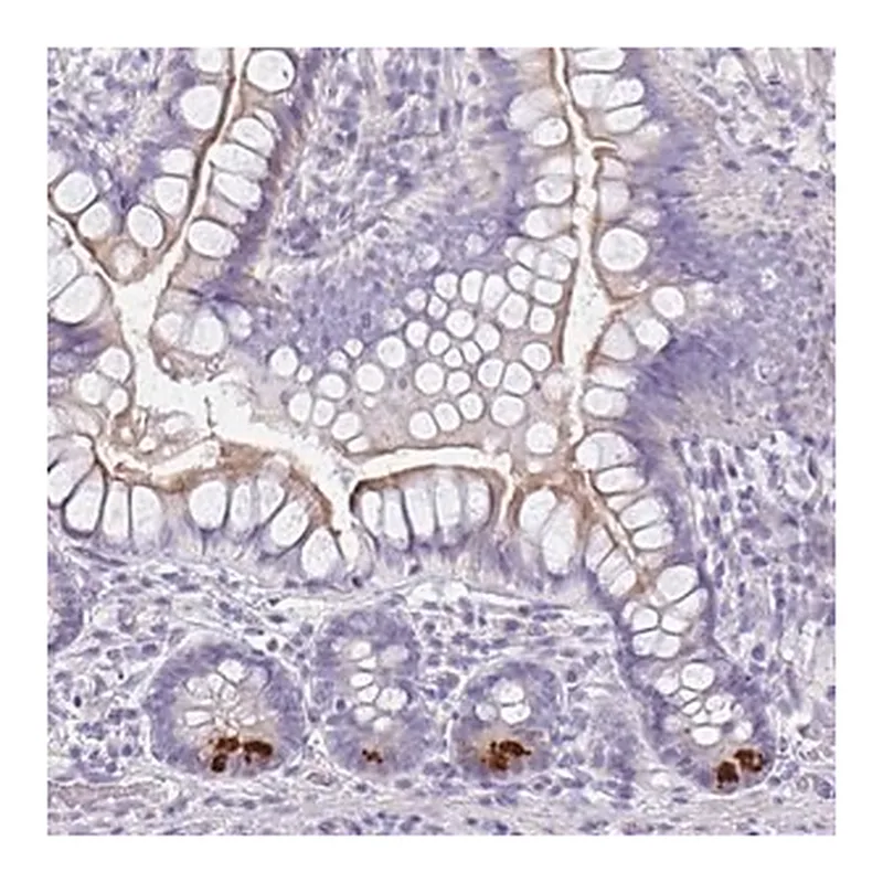 Merck Anti-FBXO47 antibody produced in rabbit