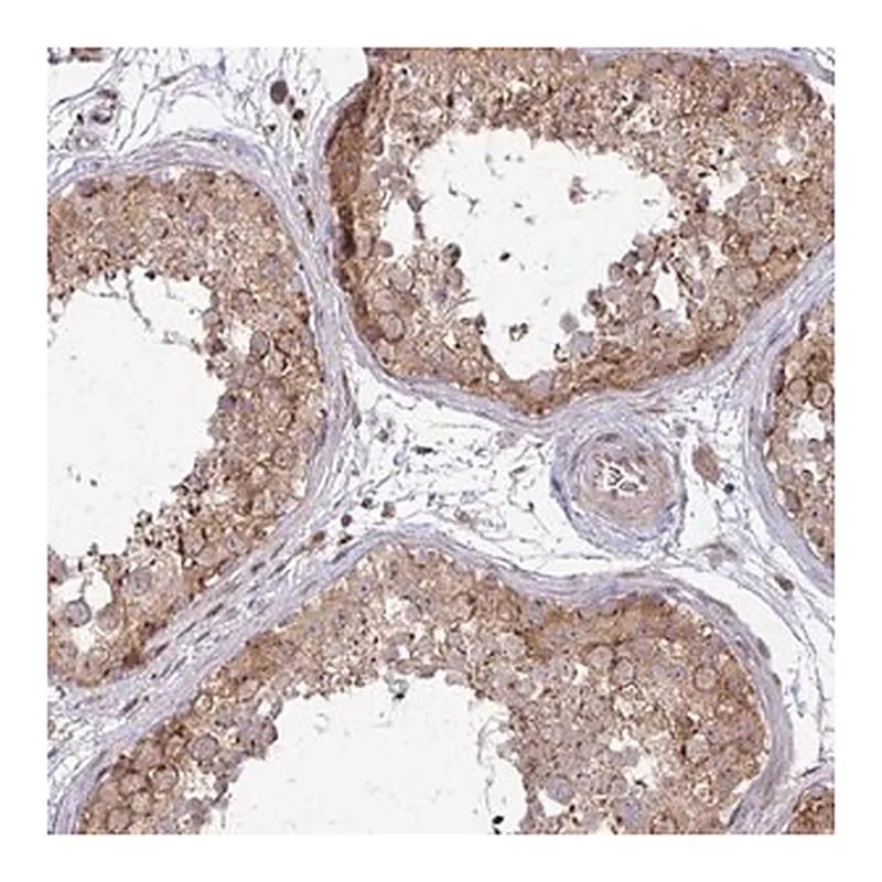 Merck Anti-TRIM44 antibody produced in rabbit