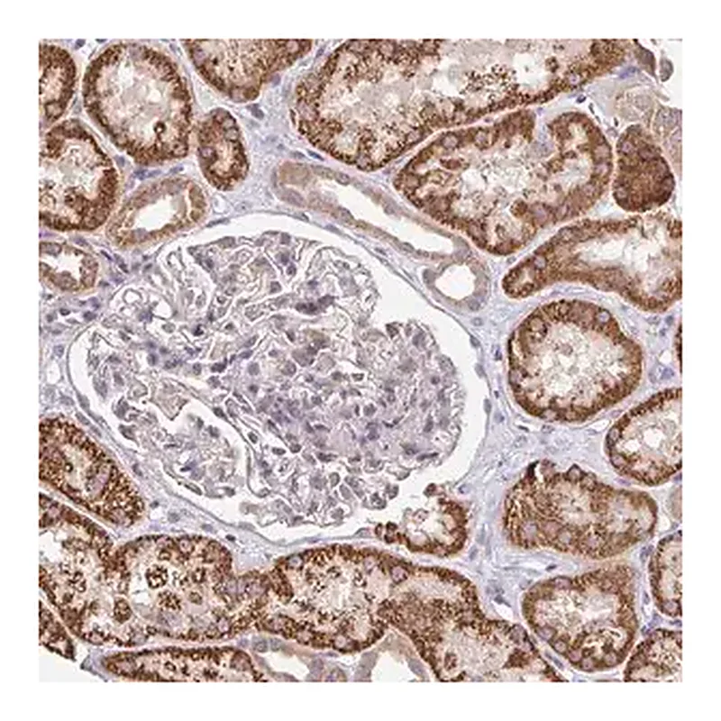 Merck Anti-TSPAN31 antibody produced in rabbit