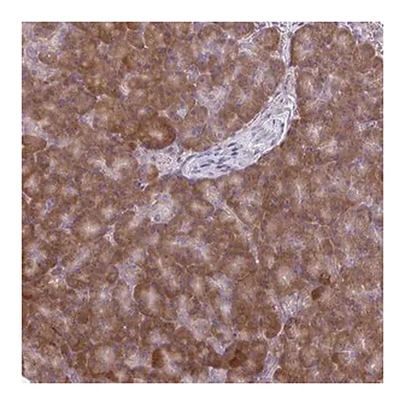 Merck Anti-CEMP1 antibody produced in rabbit