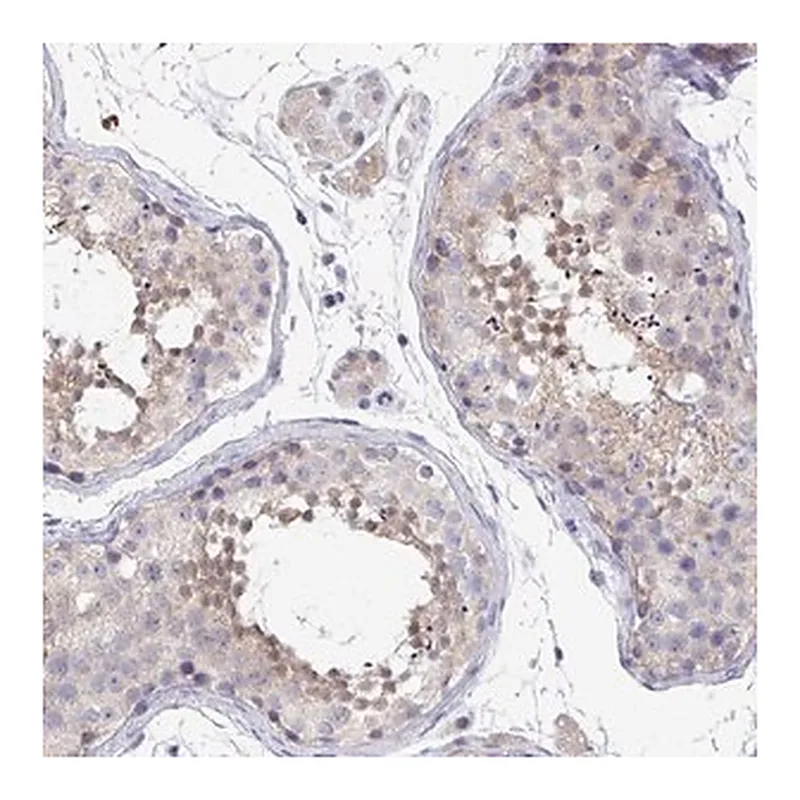 Merck Anti-P2RX3 antibody produced in rabbit