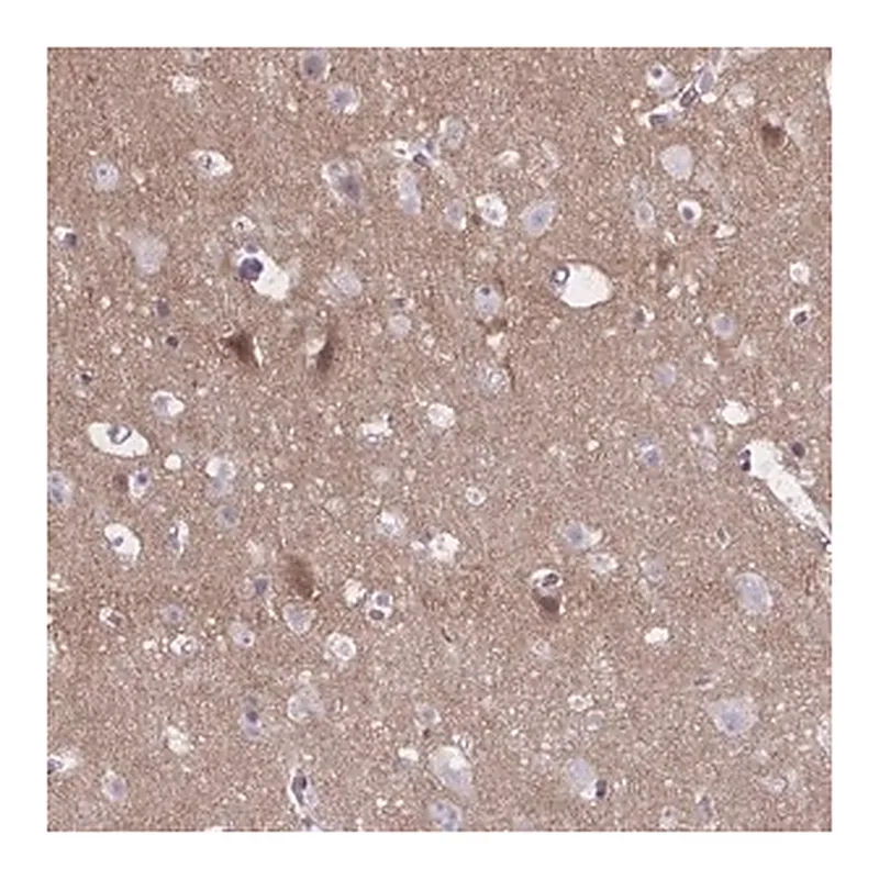 Merck Anti-NUMBL antibody produced in rabbit