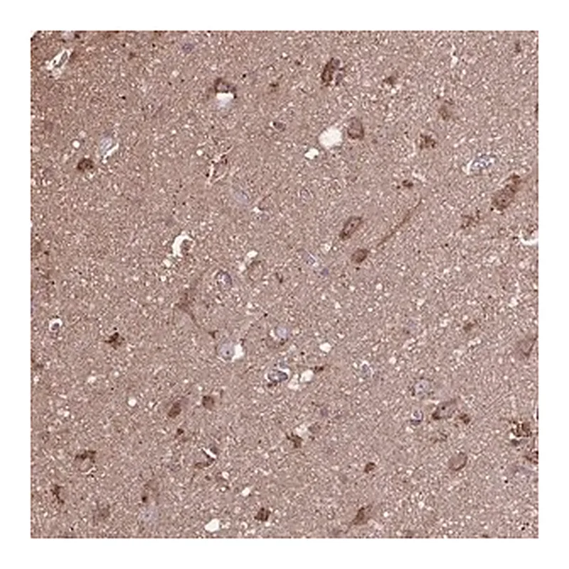 Merck Anti-ACOT6 antibody produced in rabbit